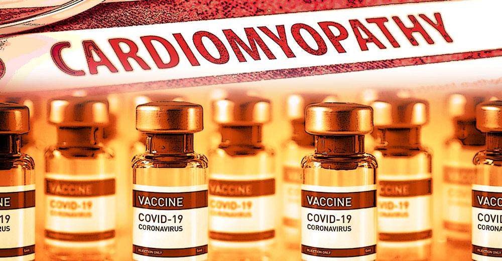 cardiomyopathy covid vaccines