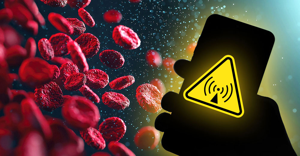 cellphone-radiation-blood-clumping
