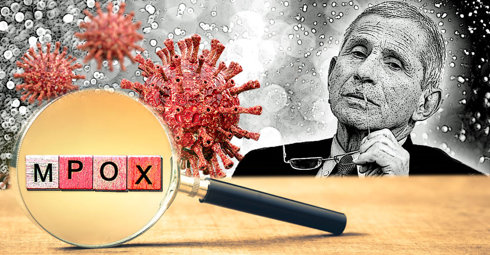 fauci niaid hid plans mpox