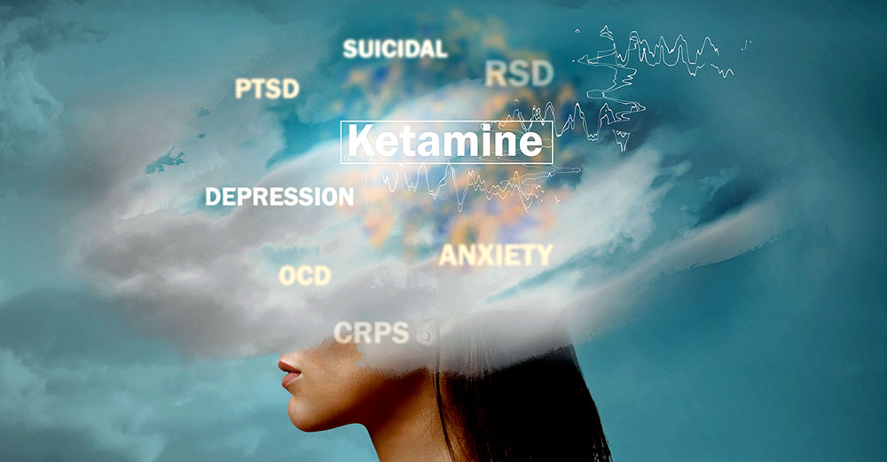 ketamine therapy soar market