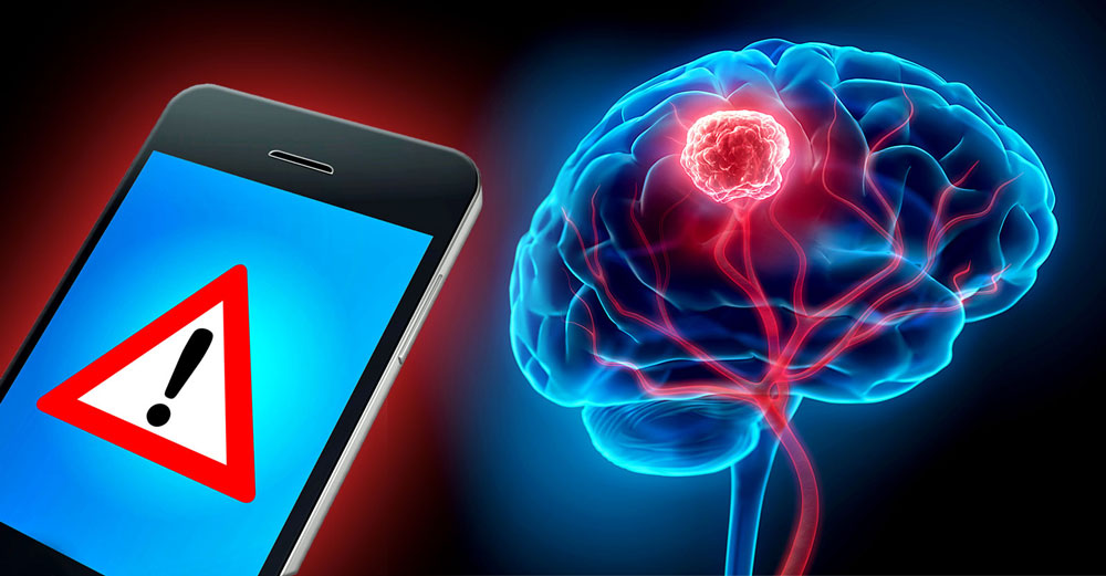 link cellphone radiation brain cancer