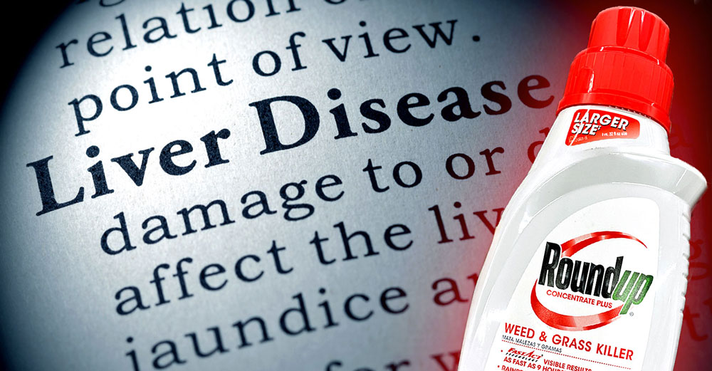 liver-disease-roundup-glyphosate