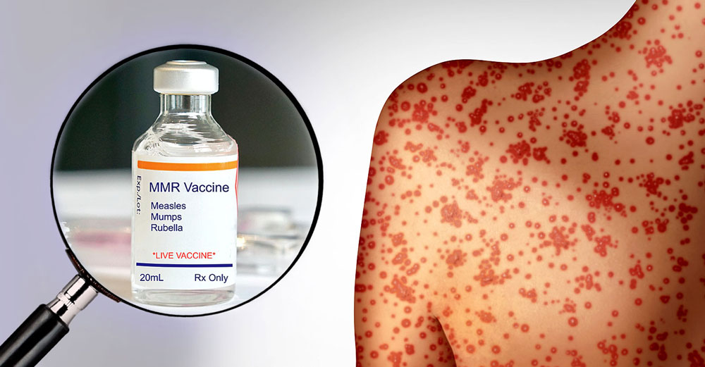 measles surge deaths decline vaccines