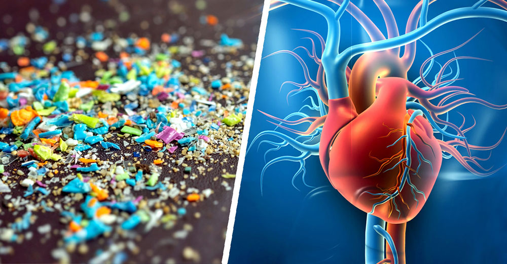 microplastics heart surgery