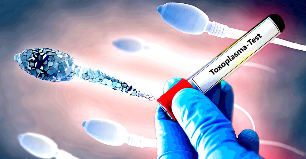 parasite-toxoplasma-sperm-fertility