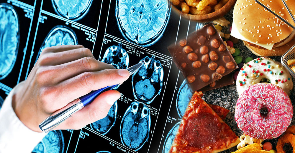 processed foods dementia risk