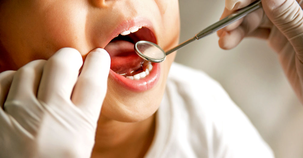 study-fluoride-water-cavities